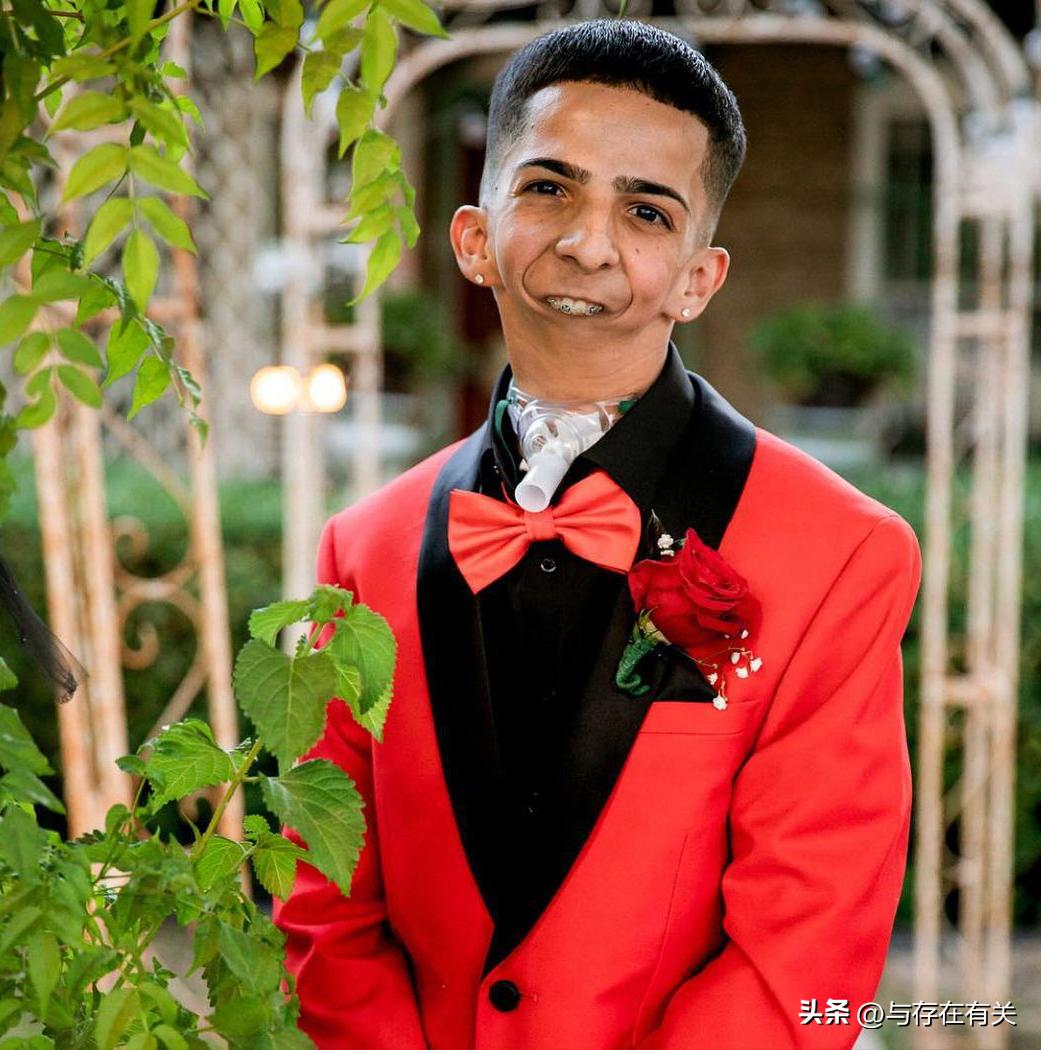 没有下巴的男人怎么改善,没有下巴的男人命运怎么样