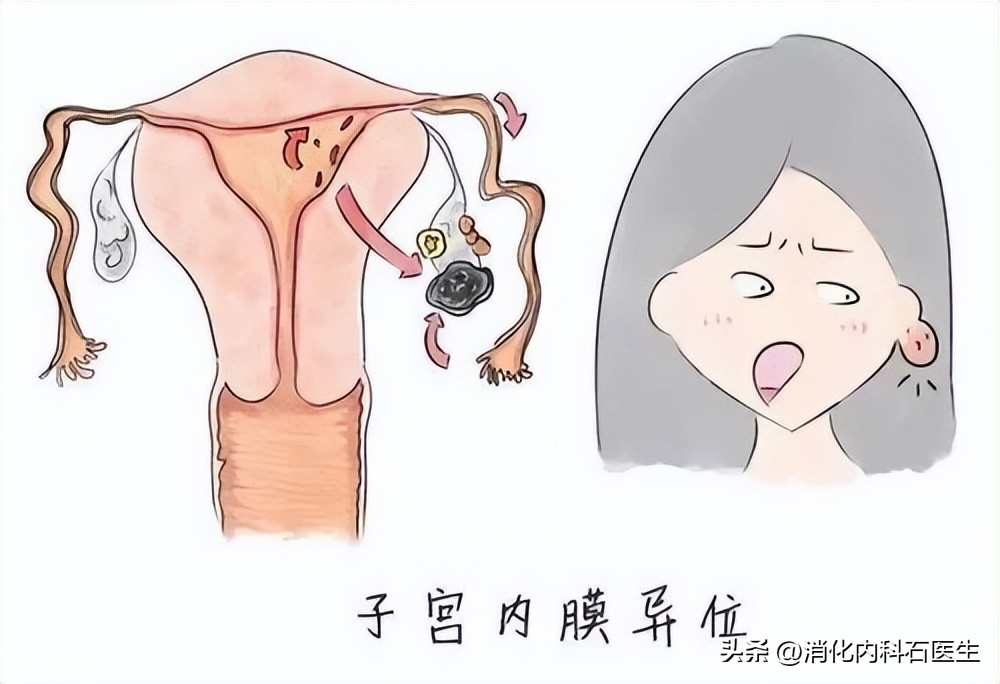 女子新婚之夜舌头出血,影响生活,确诊后女子绝望地走到了19楼顶