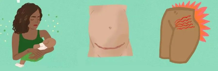 女生生完孩子性冷淡风怎么治,生完宝宝性冷淡风如何调理