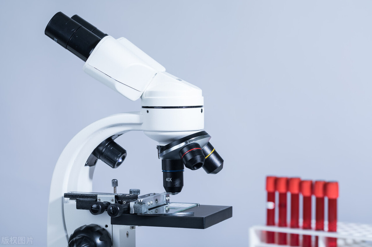 61岁阿姨血尿两月，竟是膀胱癌！预防的关键很多人都做不到