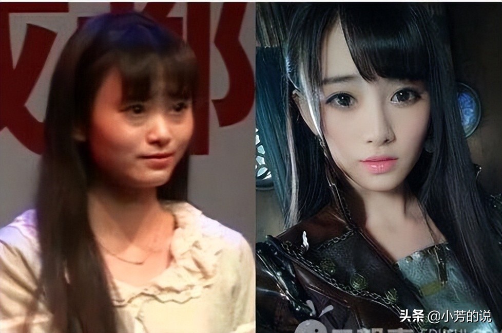 整容后出车祸假体外露,整容了被砸到脸会怎么样