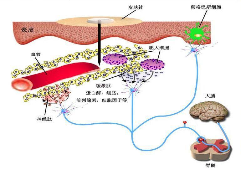 科普妊娠剧吐,妊娠期恶心呕吐如何应对