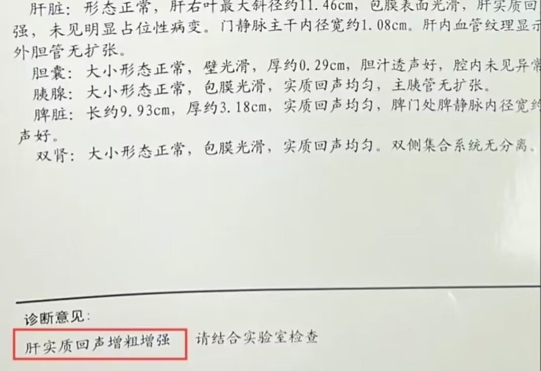 肝实质回声增粗就是肝衰竭吗,肝实质回声增粗是乙肝吗