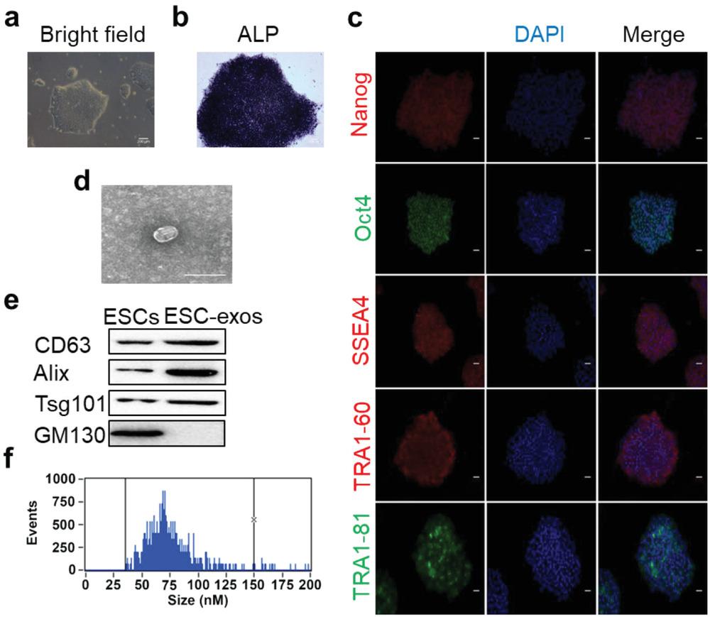 法国最新治疗胶质母细胞瘤,干细胞治疗母细胞胶质瘤