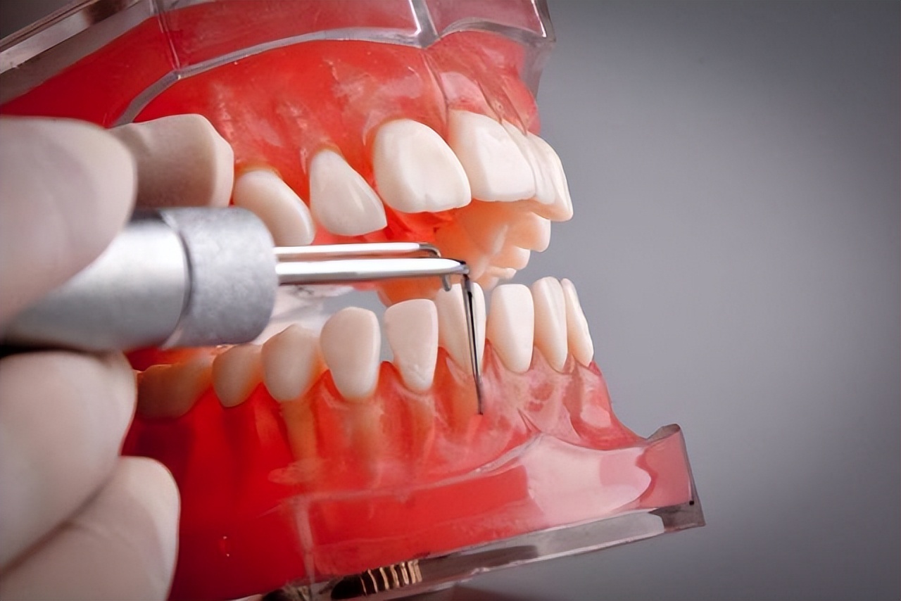 口腔溃疡很痛有什么方法治疗,特别疼的口腔溃疡怎么好