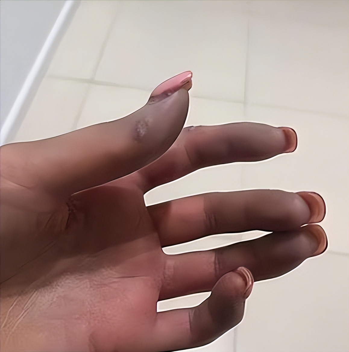 澳洲女子胶原蛋白,澳洲女性胶原蛋白