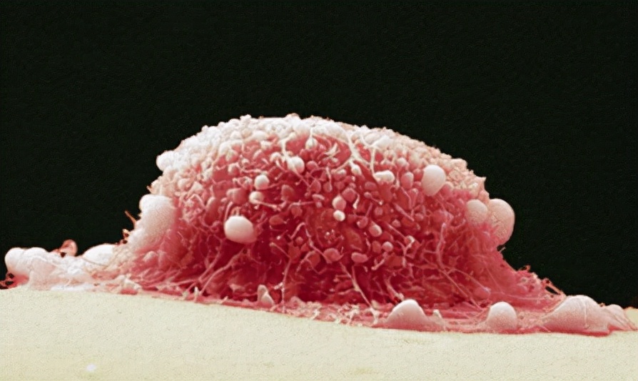 通过性传播的疾病有哪些,常见的性传播的疾病有哪些