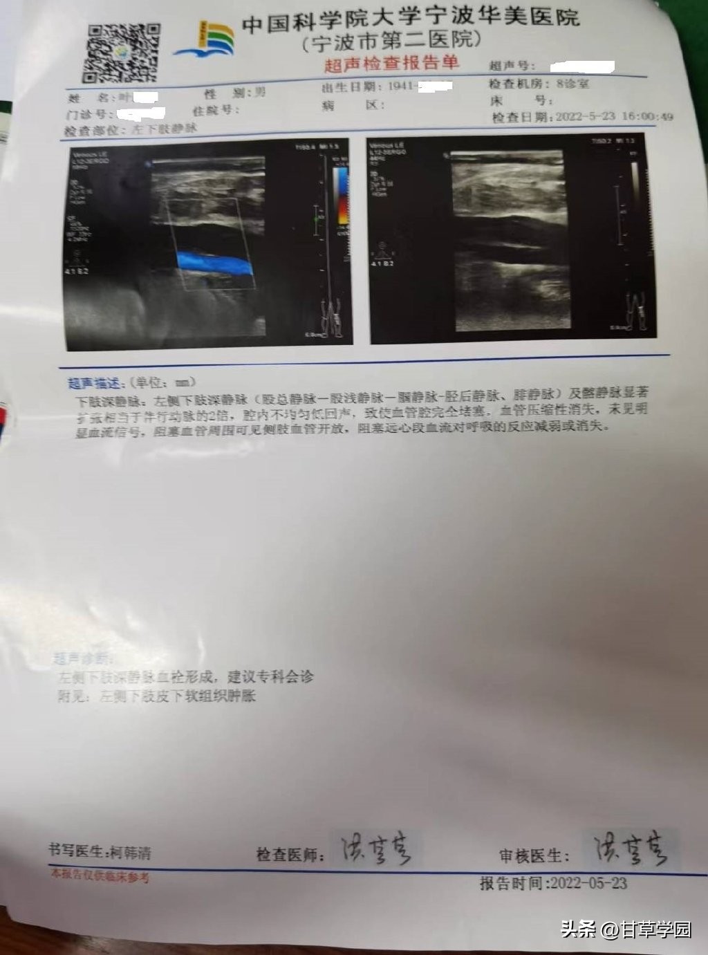 甘草芍药附子汤治静脉曲张医案,甘草芍药汤治疗静脉曲张医案