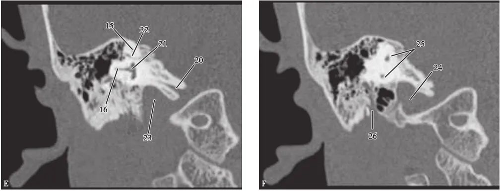 耳部解剖结构和生理功能,耳部解剖笔记