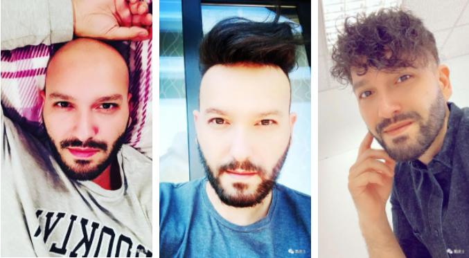 菱形脸适合什么发型？背头换成卷刘海，光头大叔直接逆袭成男神