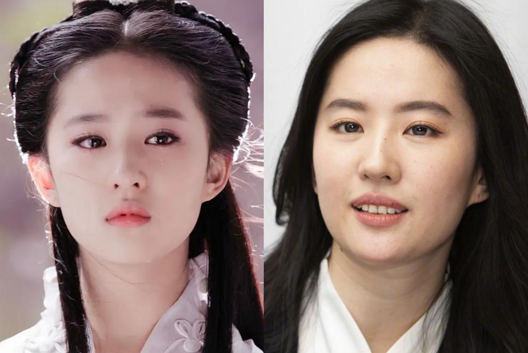 发腮和塌腮哪个更显老,发腮真的显老吗