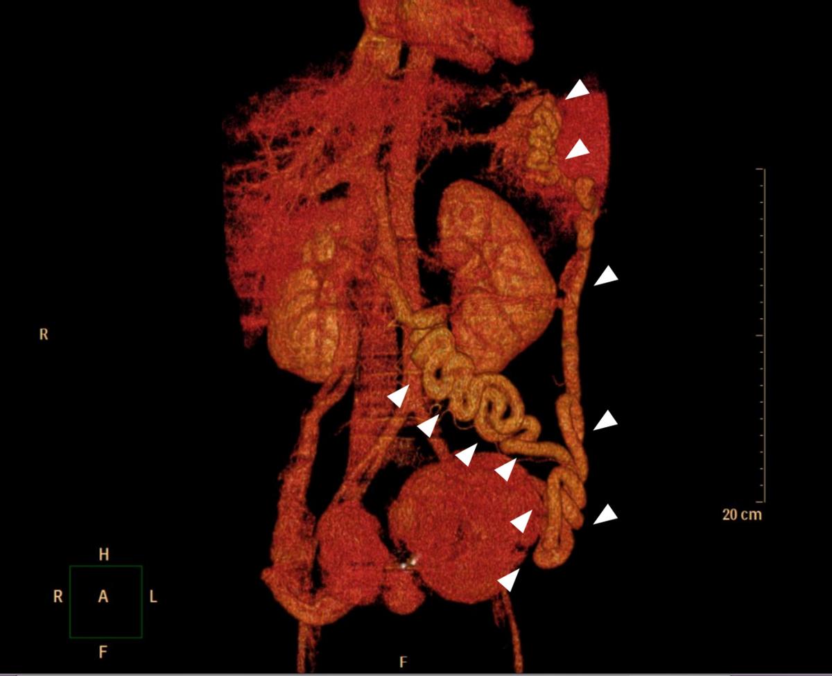 哈医大一院微创胆道外科怎么样,哈医大一院胰腺外科