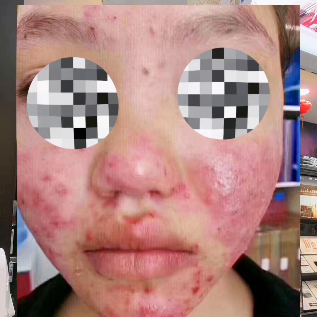 盘点市面上常见的十几种常见的去班的坑，你掉进去了不？#...