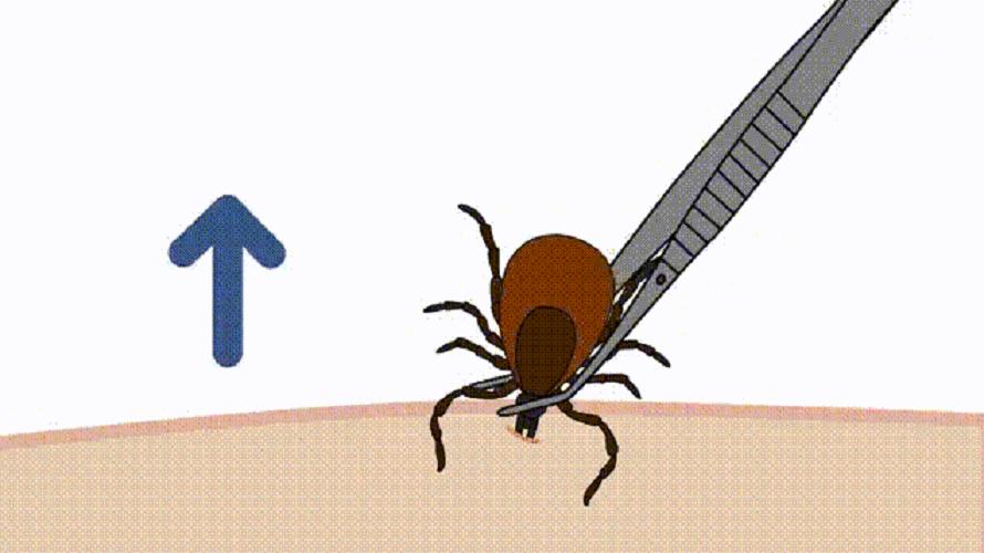 蜱虫会整个钻入身体吗,吸血蜱虫究竟有多可怕