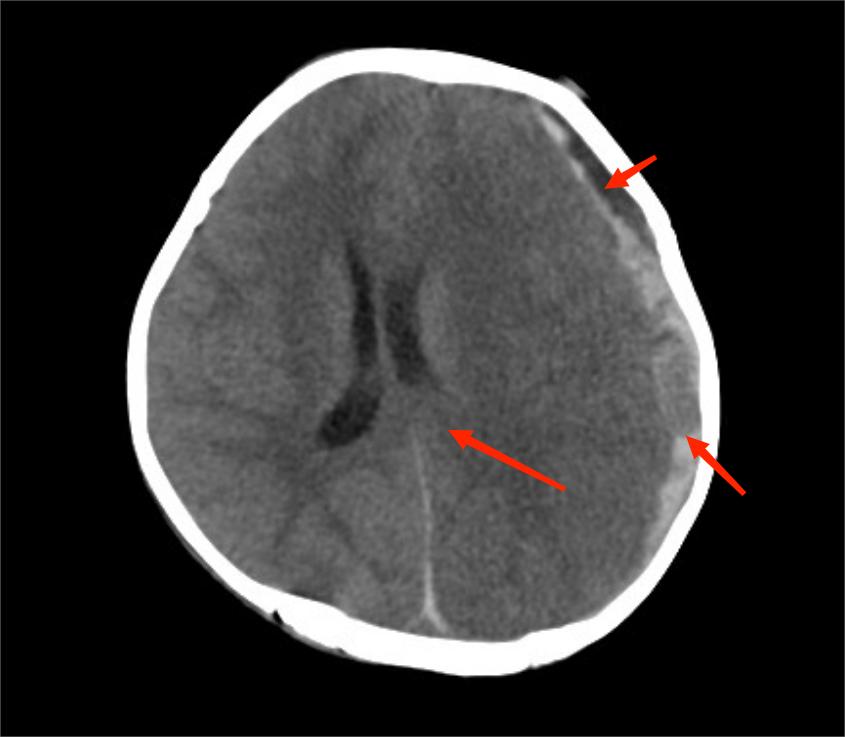 50厘米高,50厘米身高