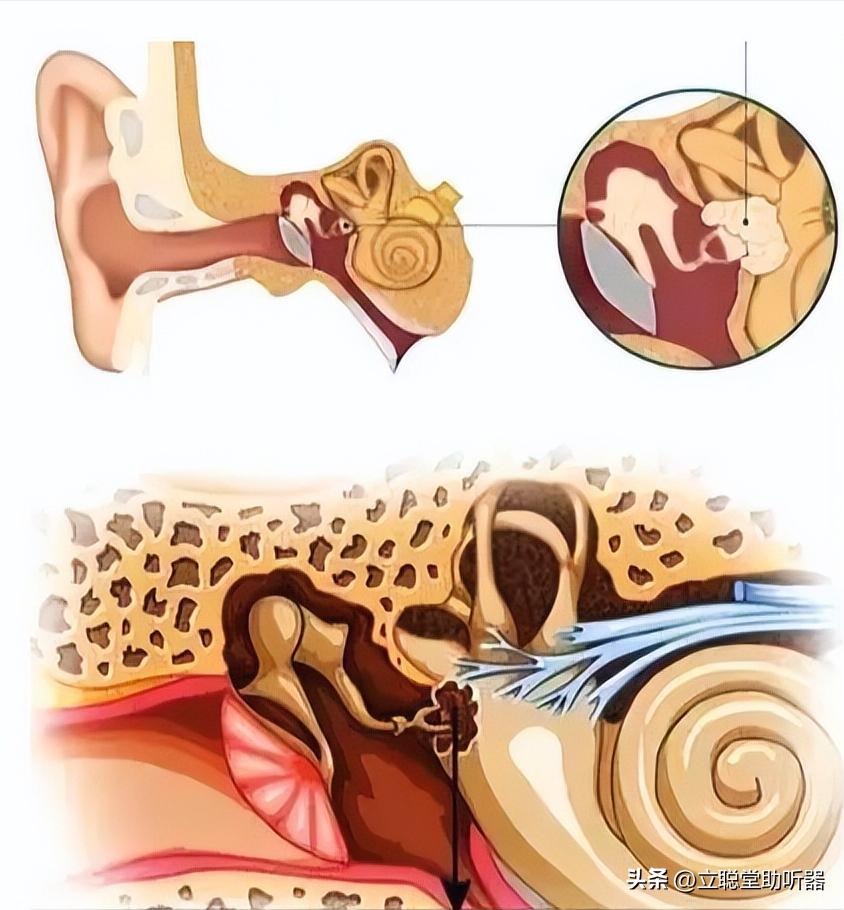 反常！“越吵听得越清楚”是怎么回事？是好事吗