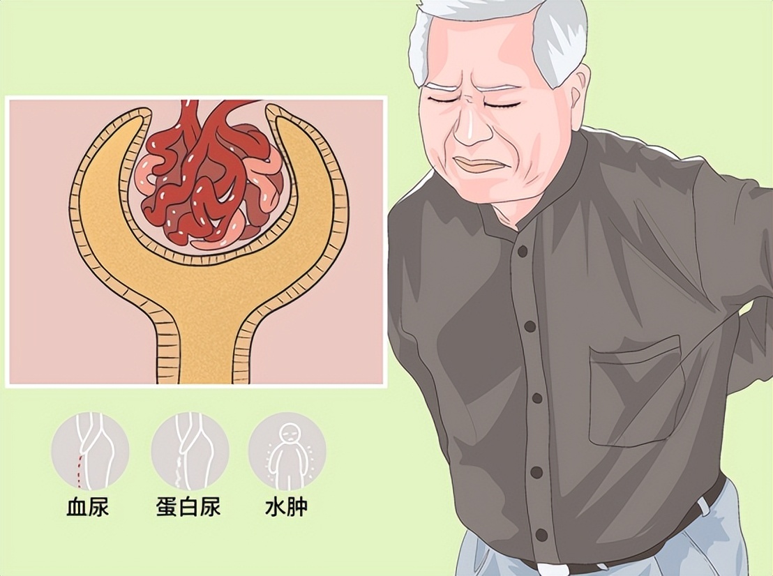 慢性病造成的肾脏伤害怎么治疗,自身免疫性疾病会引起哪些病