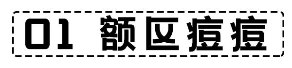面部危险三角区反复起痘痘怎么办,脸颊周围痘痘的正确消除方法