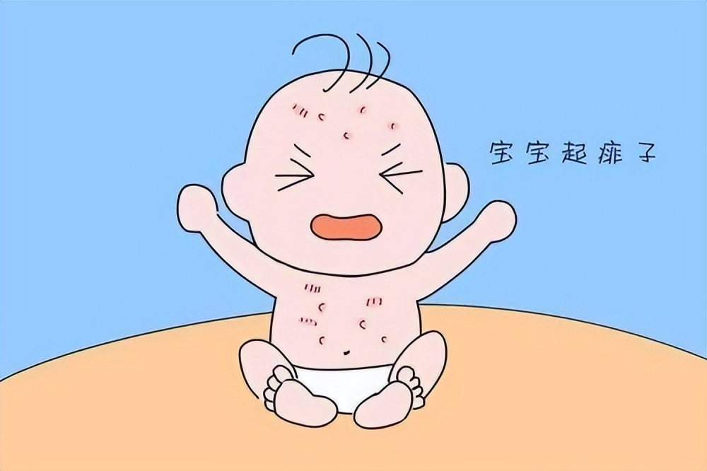 宝宝长痱子怎么快速消除止痒,夏天出痱子有什么办法祛痱止痒