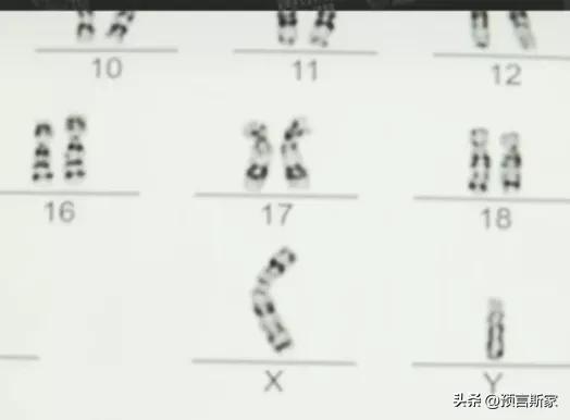 新人去婚检结果,新郎婚检被误诊为女性最后怎样了