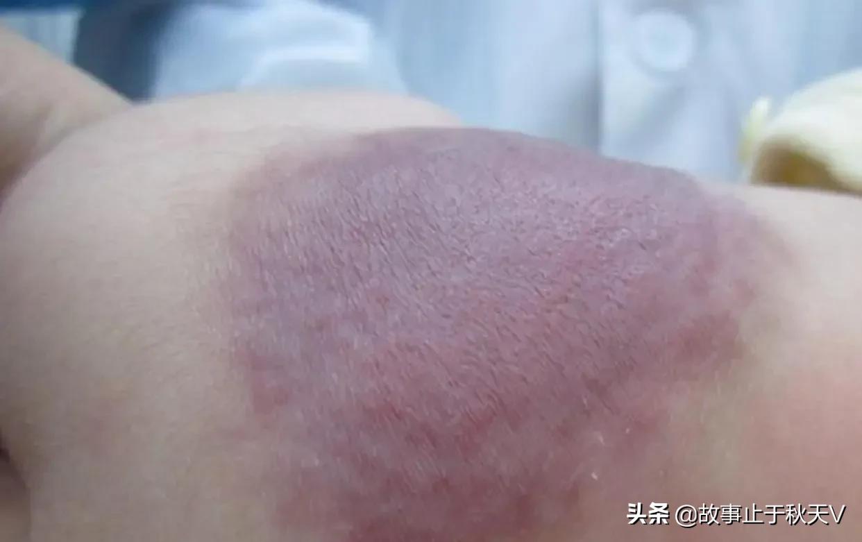 为什么讲“胎记”不是前世刻骨铭心的记忆？