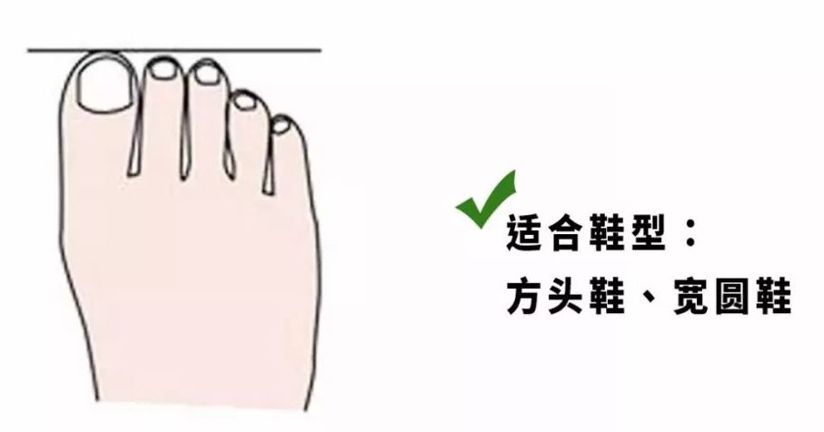 鞋子磨脚怎么办教你如何轻松解决,鞋子太紧磨脚