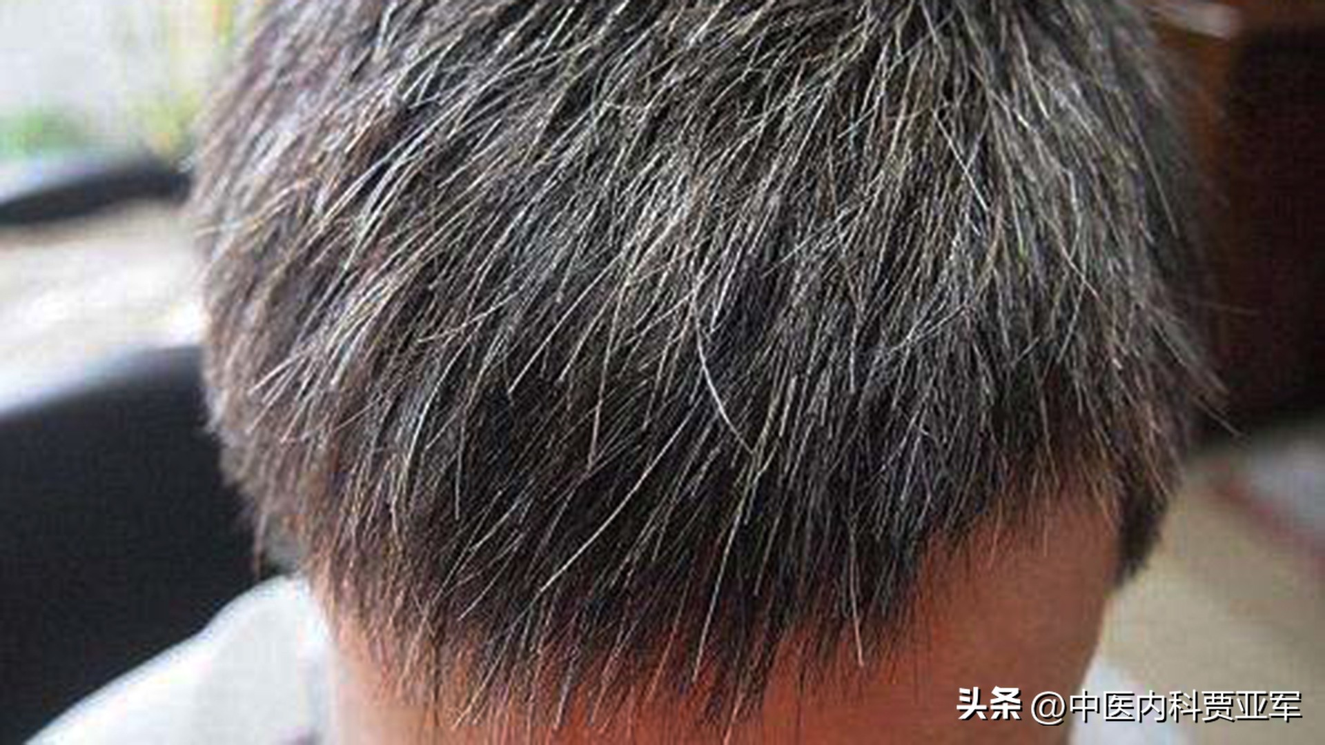 中医早衰症,中医40岁断崖式衰老最佳治疗方法