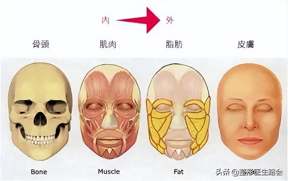 玻尿酸全脸填充年轻化,全脸玻尿酸填充真的会好看吗