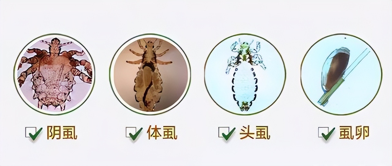 和人类共同进化的虱子，30多年前很常见，现在怎么看不到了？