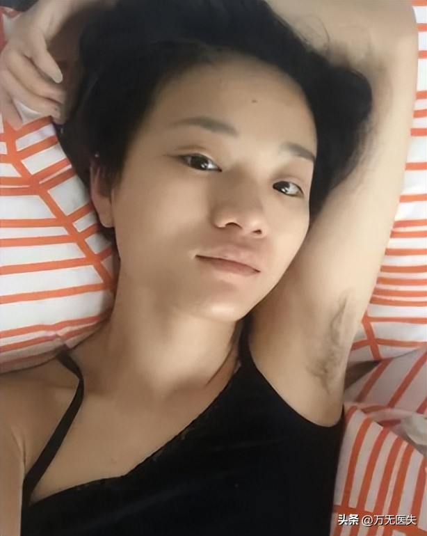 为什么有人“下面”没毛？女性*处私**毛发的秘密，别羞于了解