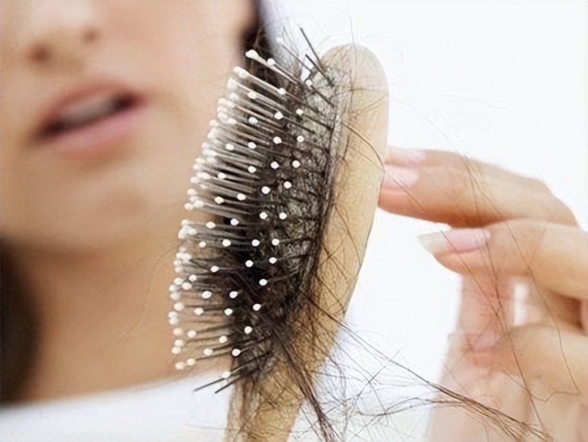脱发为什么都是从头顶先秃,脱发为什么先从头顶脱