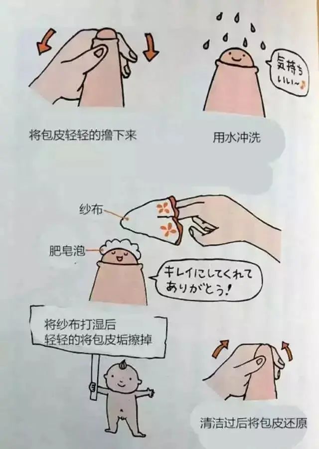 割吗?割啊!我在割包皮的医院走廊,唱完整首孤勇者
