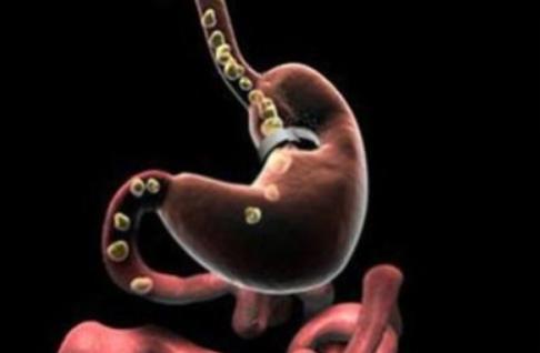 食道癌堵塞严重中医中药能打通吗,吞咽困难中医