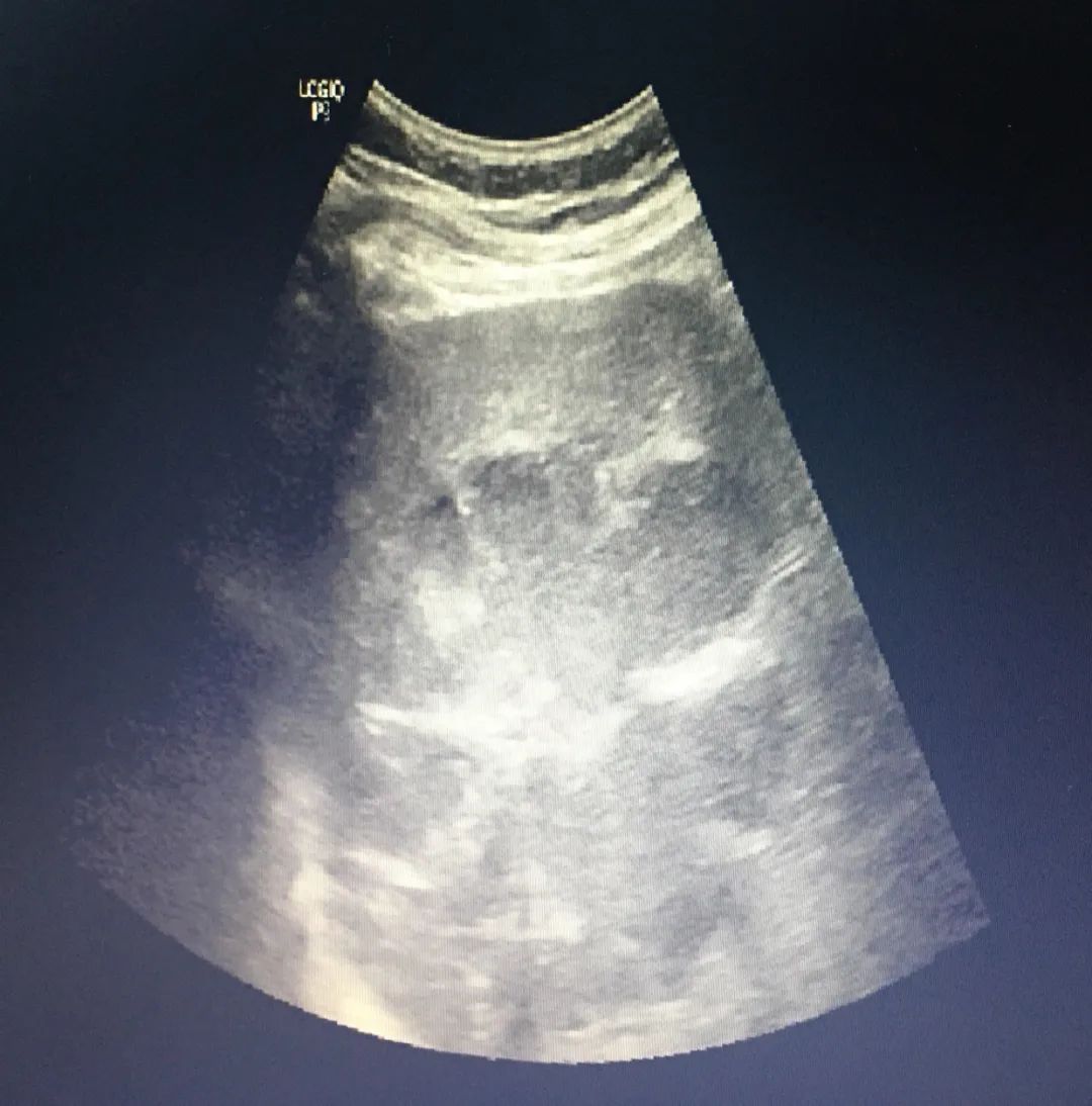 反复发热与什么有关,反复发热是什么病的前兆