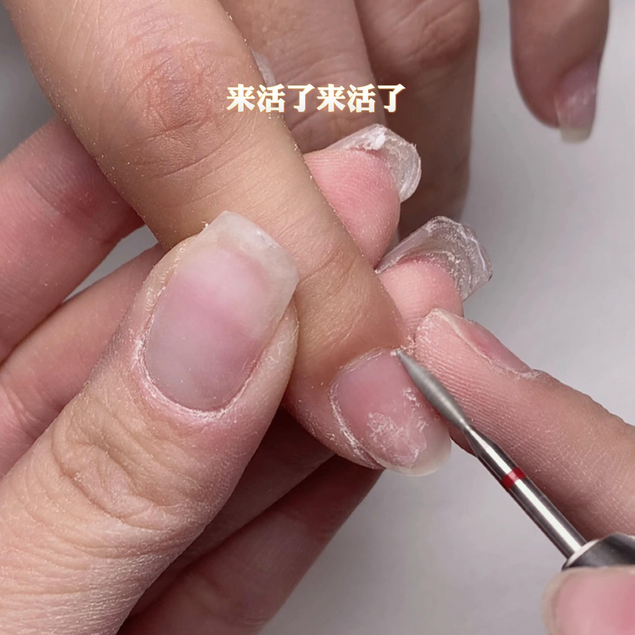 客甲操作流程四件套好用极了！！！！！！#美业手艺人