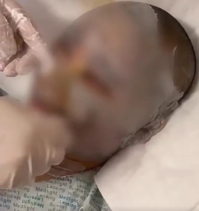 妙龄女子被泼硫酸的真正原因,25岁女子被泼硫酸