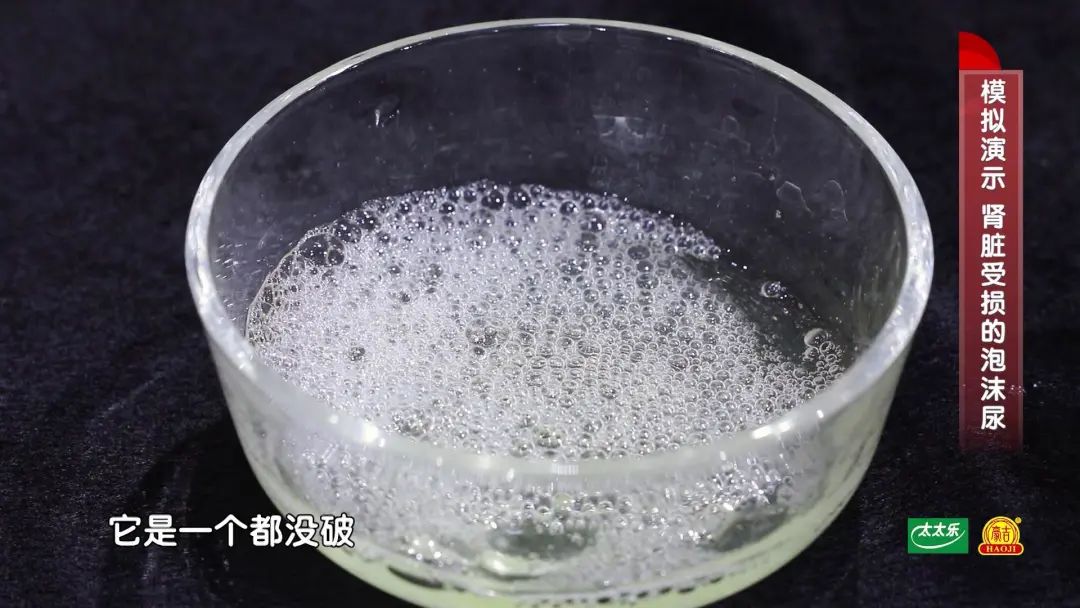 “沉默的杀手”，一发现很可能是晚期，教你3招，抓住早期病变的蛛丝马迹