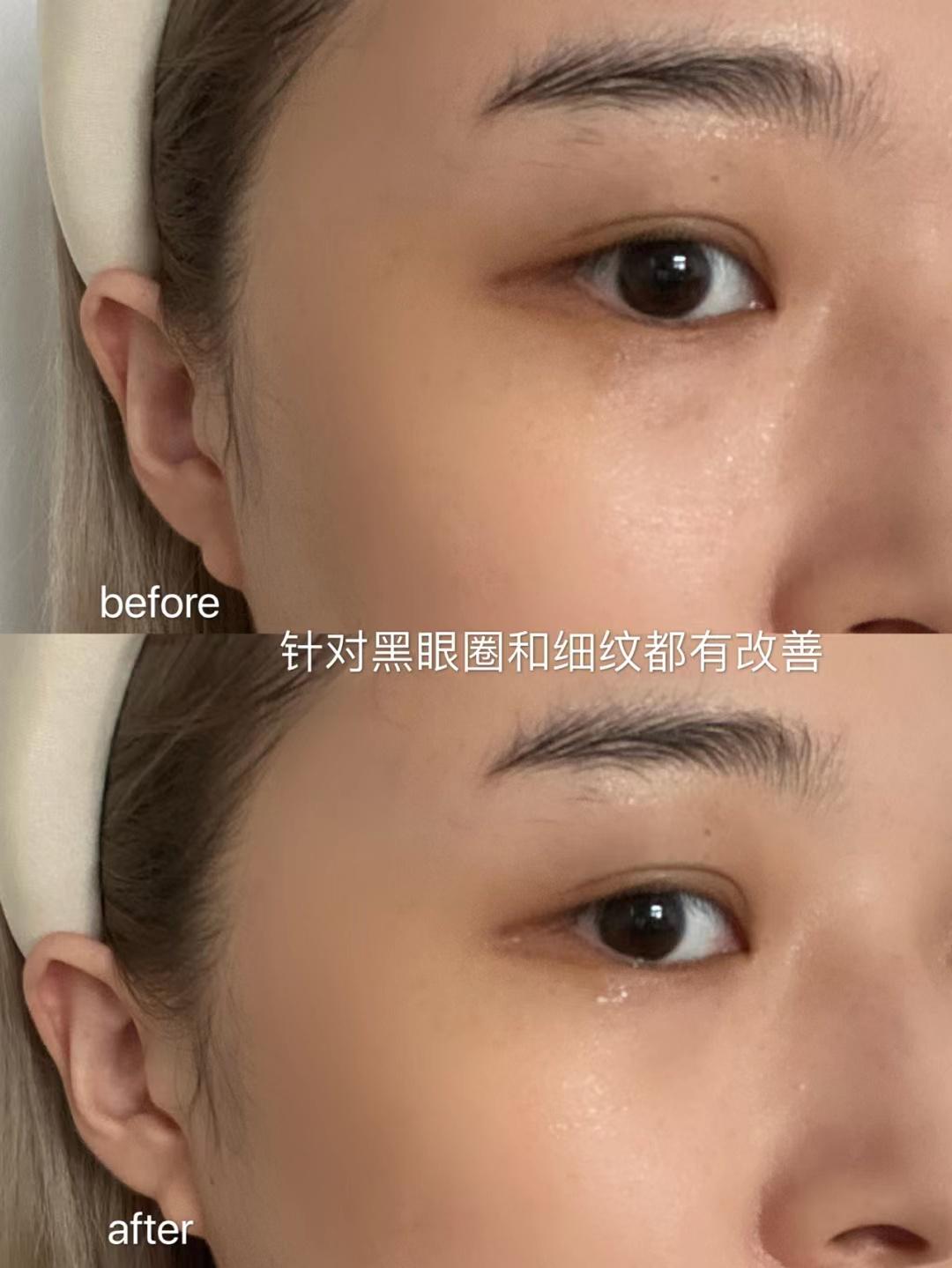 眼霜擦不擦的区别,眼霜擦跟不擦区别