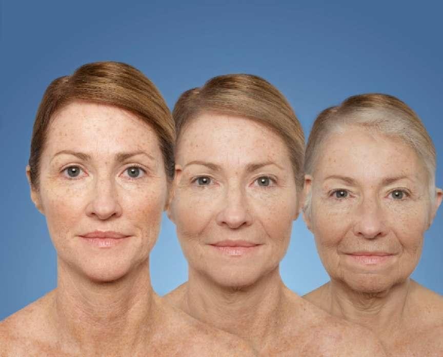 女性出现以下征兆说明开始衰老了,女人35岁开始衰老的征兆