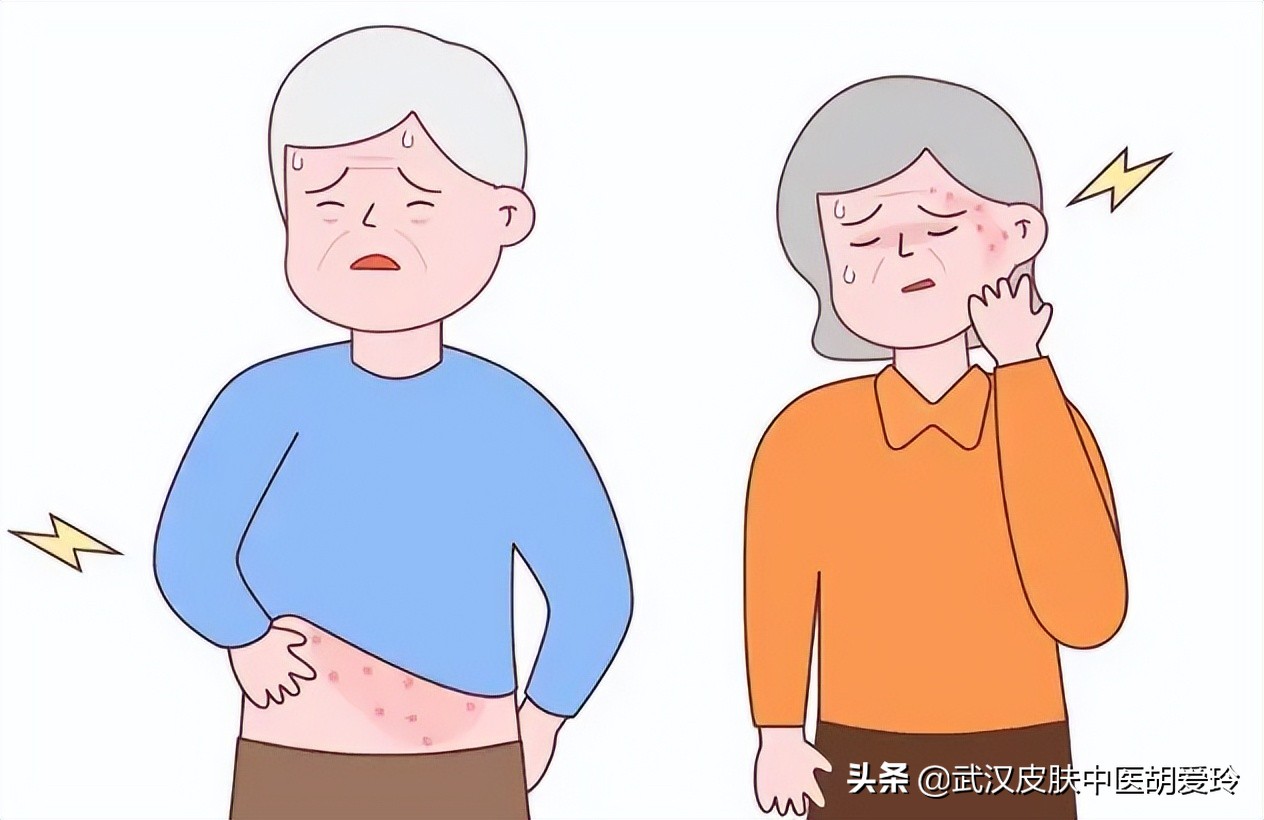 老人疱疹疼痛难忍怎么办,疱疹疼痛怎么治断根