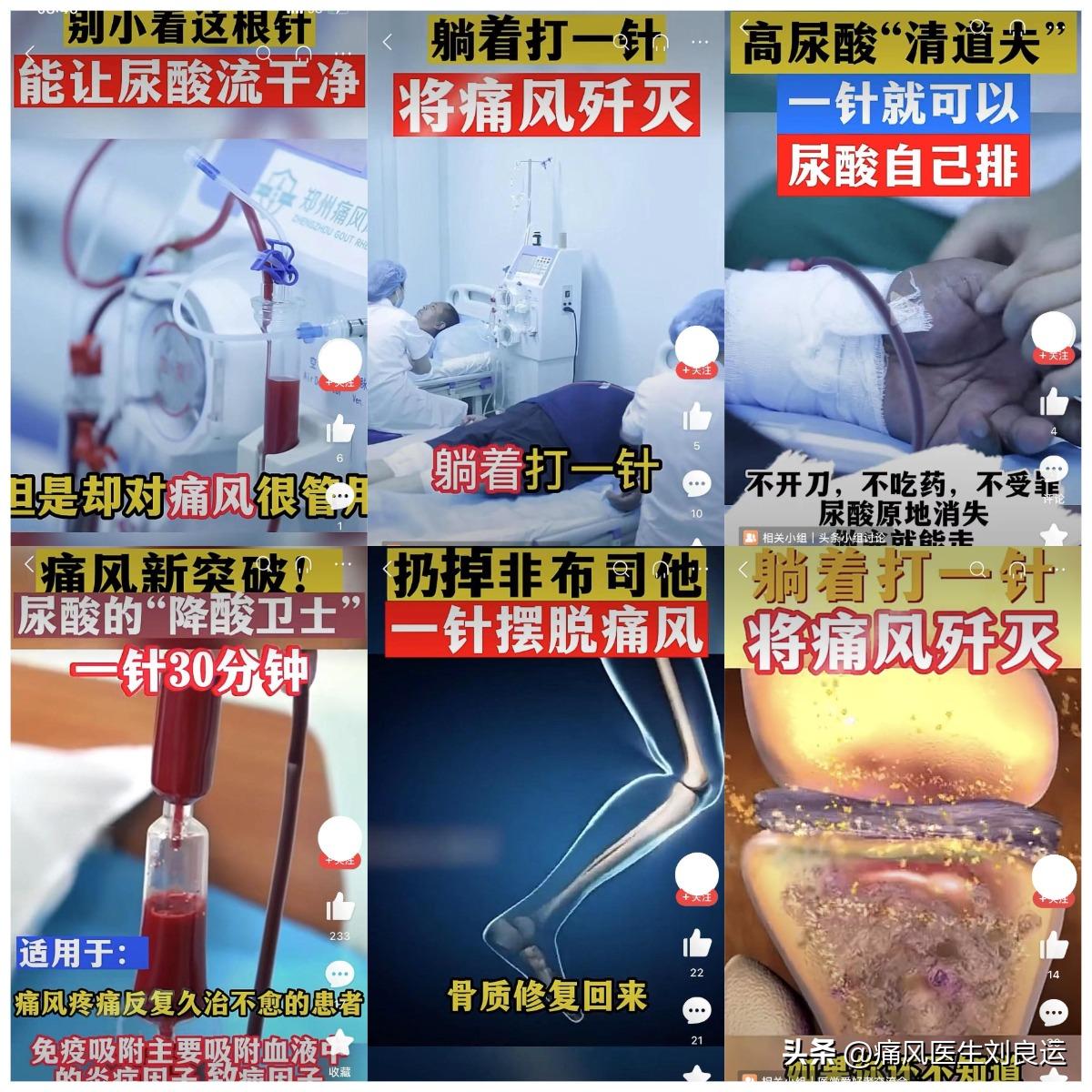 误区治痛风要迅速降尿酸,做好尿酸控制不再痛风烦恼