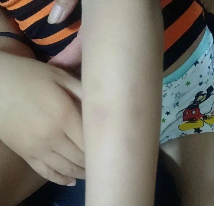 青岛幼儿园打人曝光后续,青岛西海岸幼儿园事件