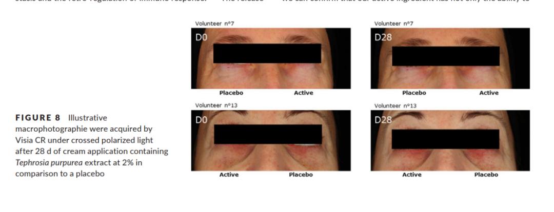 情绪护肤敏感肌,情绪美容芳疗系列化妆品