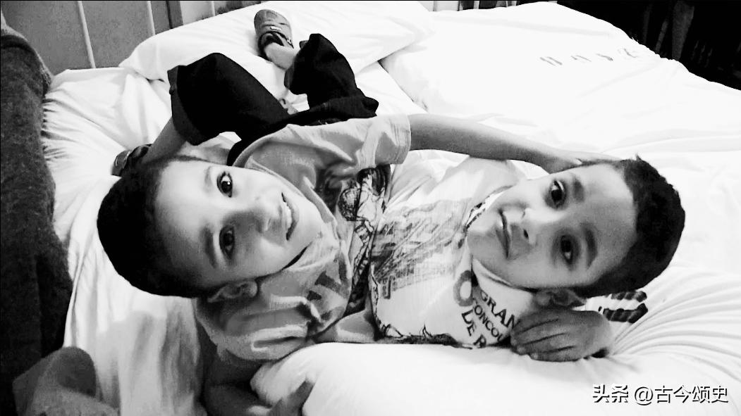 连体人结婚生子,连体人如何生子