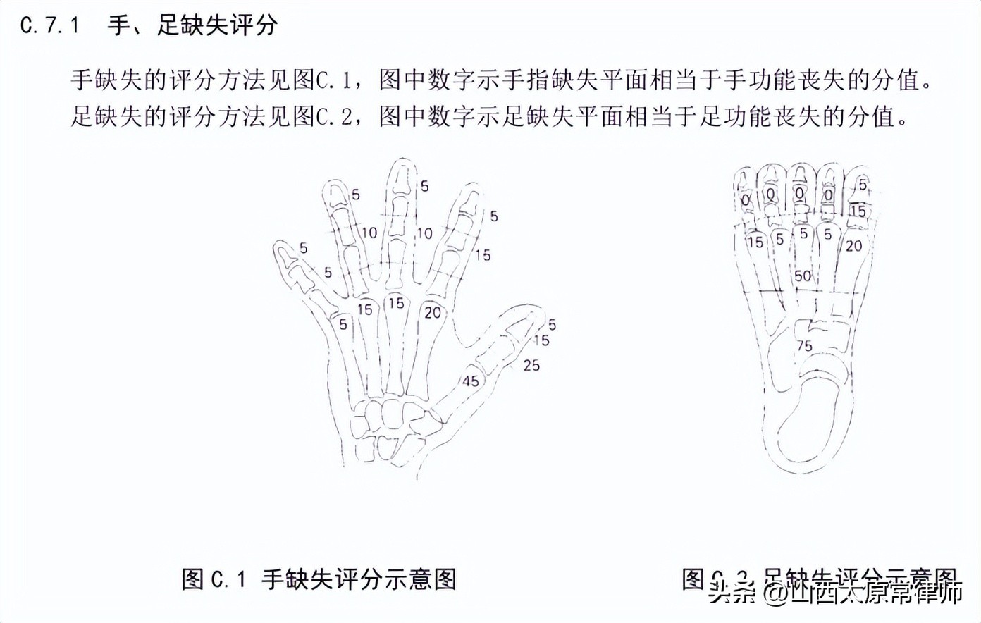 不同伤残等级如何计算残疾赔偿金,多个伤残等级如何计算残疾赔偿金