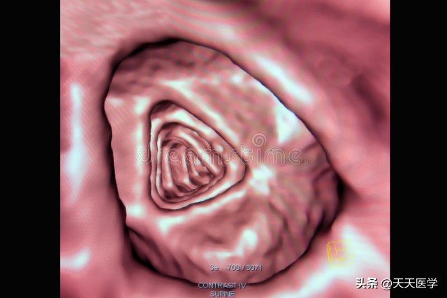 男性老年人小便便血是什么原因,老年人肚子痛大便便血是什么病症