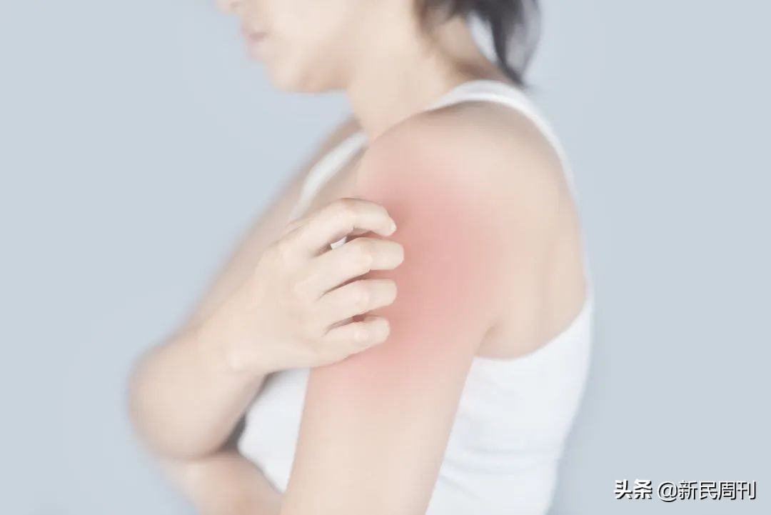 良医|止住“奇痒”，你终于可以定个小目标