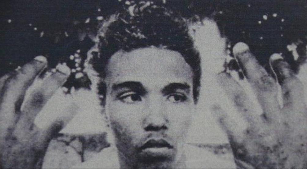 1987年巴西窃贼偷了一胶囊，手部溃烂，医生说只是过敏，后被截肢