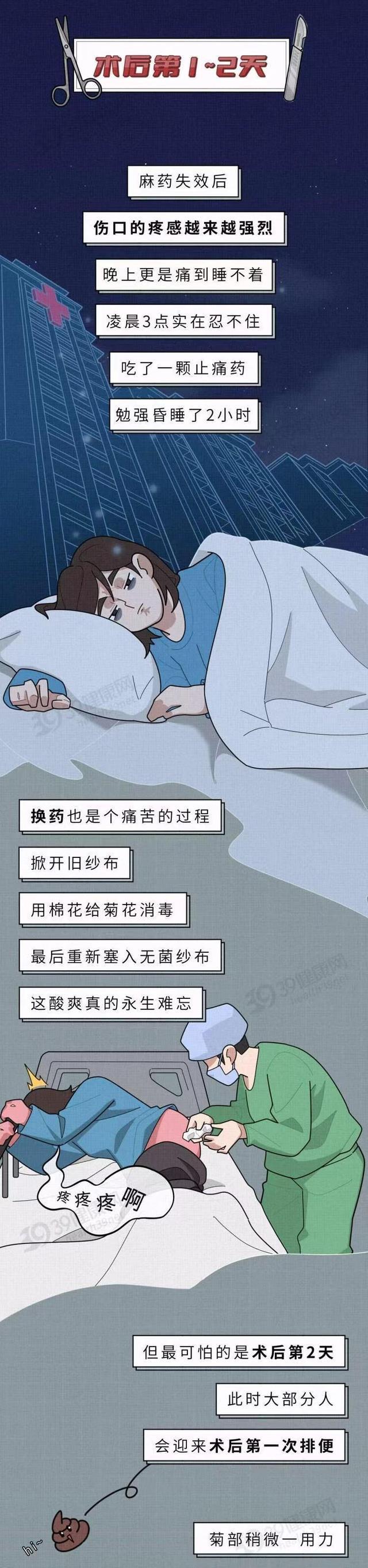 年轻小伙做痔疮手术痛苦,23岁女孩分享痔疮手术的经历