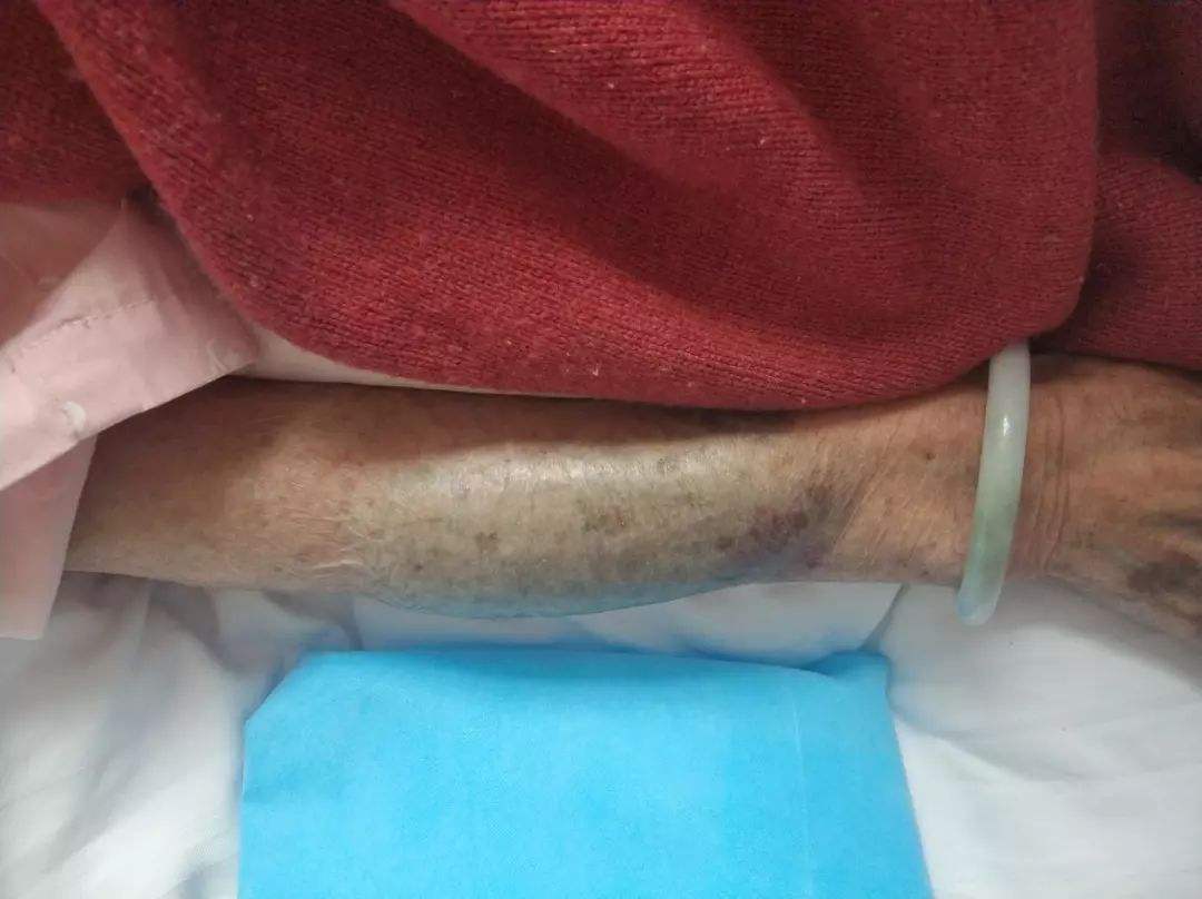 心脏造影是心脏最好的检查吗,什么情况下适合做心脏造影